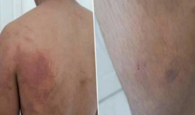 Şanlıurfa'da çocuğu zincirle ahıra bağlayıp işkence yapan baba ve amca tutuklandı