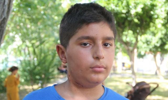 Antalya'da küçük çocuk köpek saldırısına uğradı! Boynuna 6 dikiş atıldı