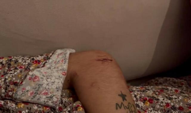 Bursa'da 2,5 ay alıkoyduğu kız arkadaşını darbederek cinsel istismarda bulundu