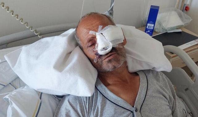 Kontrolünü kaybettiği elektrikli testere ile yüzünü kesti