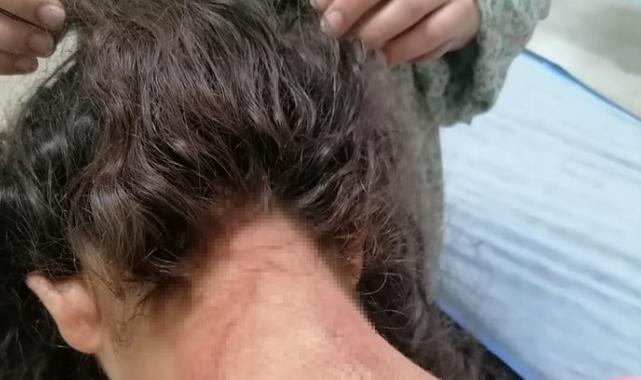 Gaziantep'te iki genç kız öldüresiye dayak yedi