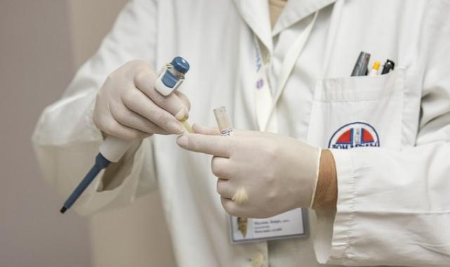 Sigara tükürük bezi tümörüne neden olabiliyor