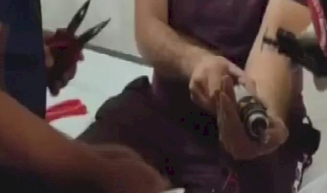 Hatay'da matkaba sıkışan parmağını itfaiye çıkarttı