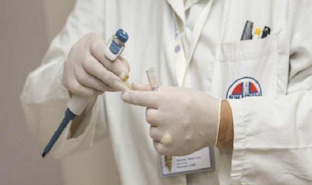 Sigara tükürük bezi tümörüne neden olabiliyor