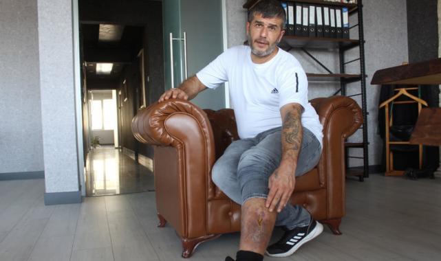 Kayseri'de bacağında unutulan bez parçasıyla 16 yıl yaşadı