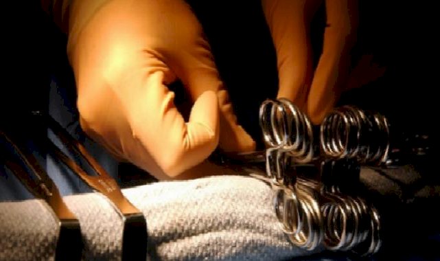 Dünyada çok nadir görülen hastalık Şanlıurfa da tedavi edildi