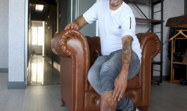 Kayseri'de bacağında unutulan bez parçasıyla 16 yıl yaşadı