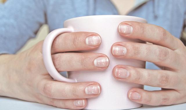 Tırnaklarınız uyarıyor! Eğer tırnaklarınızda bunlar varsa hasta olabilirsiniz...