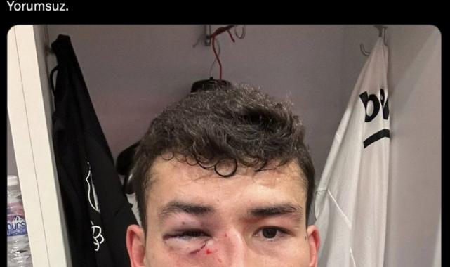 Bahtiyar Zaynutdinov sakatlandı, Beşiktaş'tan tepki geldi