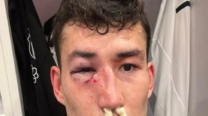 Bahtiyar Zaynutdinov sakatlandı, Beşiktaş'tan tepki geldi