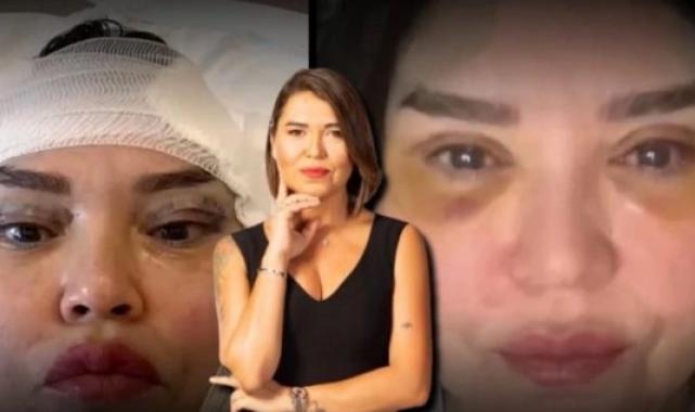 Botoks ve yağ enjeksiyonu gibi estetik uygulamalarda hayati kurallar!