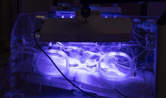 Erzurum'da prematüre doğan bebeklerin, kuvözden anne kucağına yolculuğu