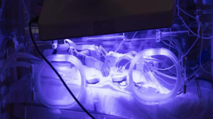 Erzurum&#039;da prematüre doğan bebeklerin, kuvözden anne kucağına yolculuğu