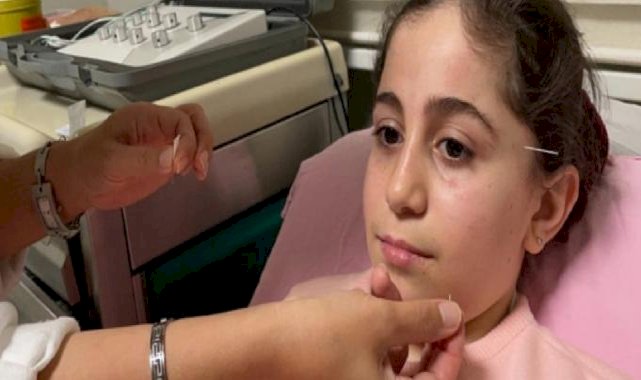 Samsun'da yüz felci geçiren 10 yaşındaki çocuk, akupunktur ile sağlığına kavuştu