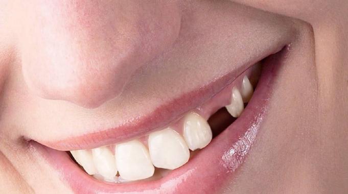 Anestezi Altında Diş Tedavisi Sadece Ameliyathanede Yapılmalı