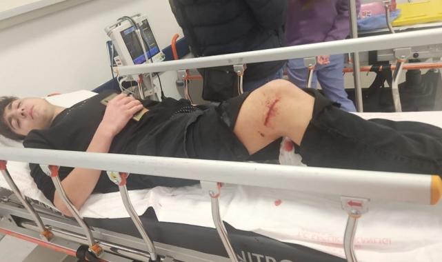 Ankara'da başıboş sokak köpekleri yine çocuklara saldırdı