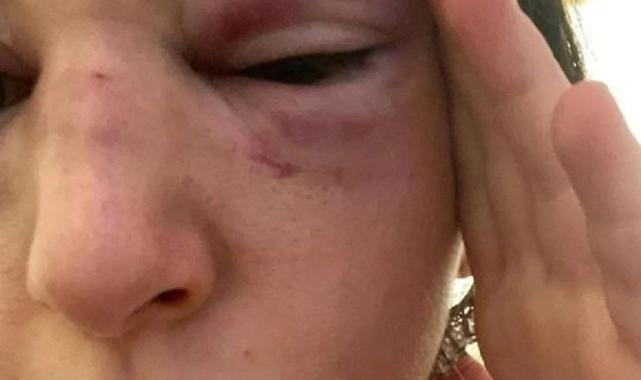 Bursa'da eski sevgilisini zorla arabaya bindirip kaçırdı, 9 kez kafa attı