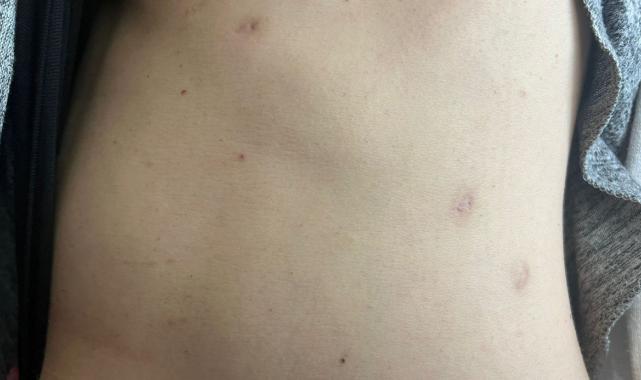 Bursa'da sevgilisinin yaralayıp 21 gün boyunca tecavüz ettiği kadın konuştu