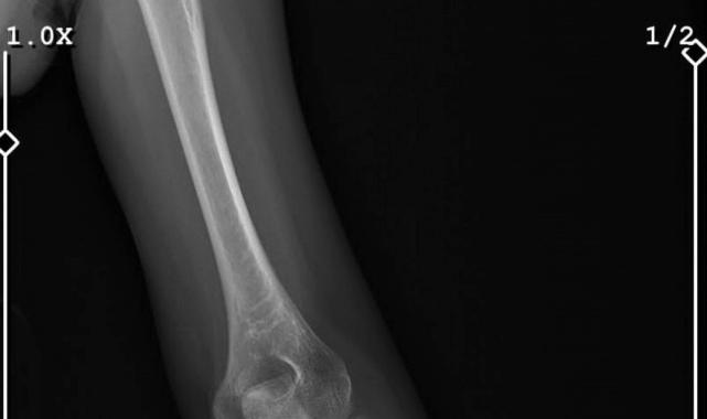 Bursa'da sevgilisinin yaralayıp 21 gün boyunca tecavüz ettiği kadın konuştu