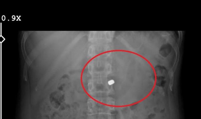 Bursa'da sevgilisinin yaralayıp 21 gün boyunca tecavüz ettiği kadın konuştu