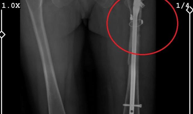 Bursa'da sevgilisinin yaralayıp 21 gün boyunca tecavüz ettiği kadın konuştu