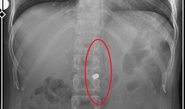 Bursa'da sevgilisinin yaralayıp 21 gün boyunca tecavüz ettiği kadın konuştu