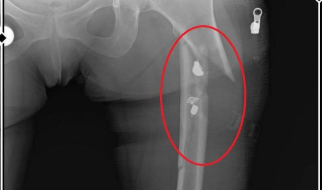 Bursa'da sevgilisinin yaralayıp 21 gün boyunca tecavüz ettiği kadın konuştu