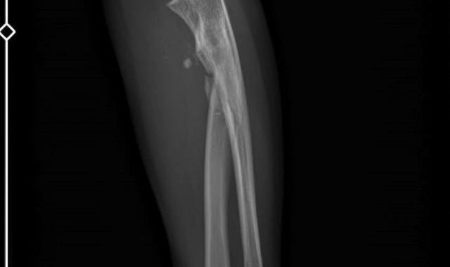 Bursa'da sevgilisinin yaralayıp 21 gün boyunca tecavüz ettiği kadın konuştu