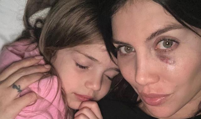 Galatasaraylıların yengesi Wanda Nara yaralandı! Icardi soluğu Roma'da aldı