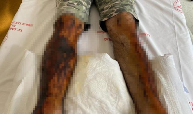 İstanbul'da dehşeti yaşadı! Lavabosunu açmak istedi, ölüyordu...