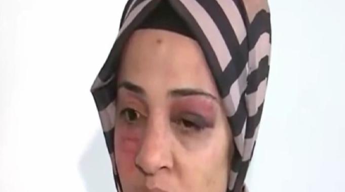 İstanbul'da kadına şiddet! Eski kayınvalidesi ile kayınpederi sokak ortasında dövdü