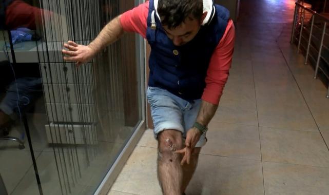 İstanbul'da kamyonetin bariyerlere sıkıştırdığı motosikletli ölümden döndü