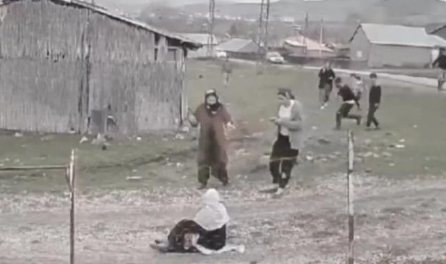 Muş'ta köpeklerin saldırdığı yaşlı kadın isyan etti: Bir köpek dahi kalmasın