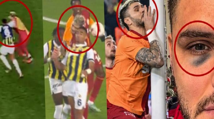 Sosyal medya bunu konuşuyor: Mauro Icardi&#039;nin gözü ne zaman morardı