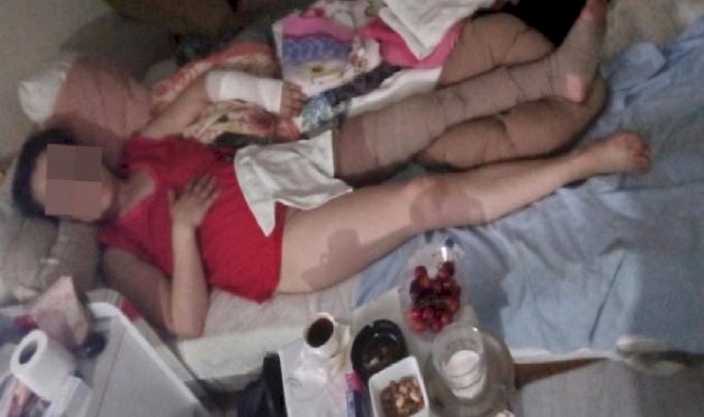 Bursa'da sevgilisinin yaralayıp 21 gün boyunca tecavüz ettiği kadın konuştu