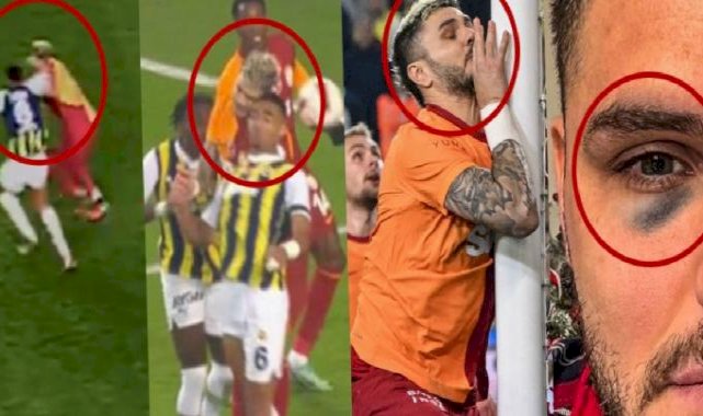 Sosyal medya bunu konuşuyor: Mauro Icardi'nin gözü ne zaman morardı