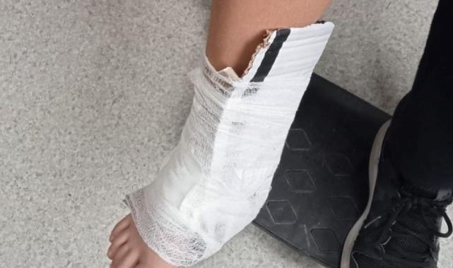 Trabzon'da okulda düşen çocuğun ayağı kartonla sarıldı: İnceleme başlatıldı