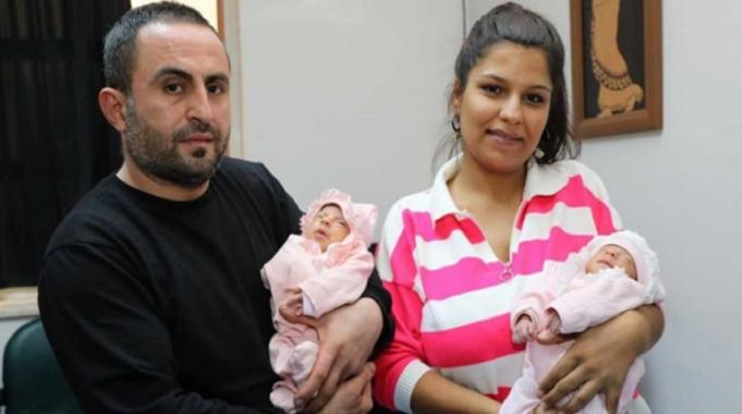 Aynı damarları paylaşan ikizler, anne karnında ameliyatla sağlıklarına kavuştu