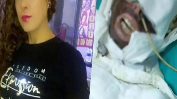 İstanbul'da Yasemin Uzunçelebi'ye kimyasal madde atan sanığa 20 yıl hapis cezası