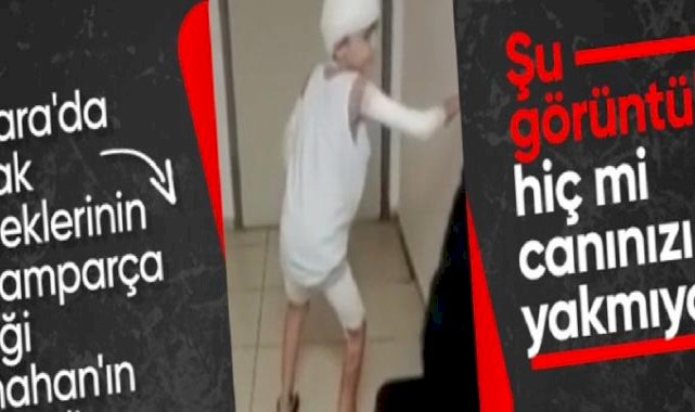 Ankara'da köpeklerin saldırısı sonucu ağır yaralanan Tunahan'ın hastane görüntüleri