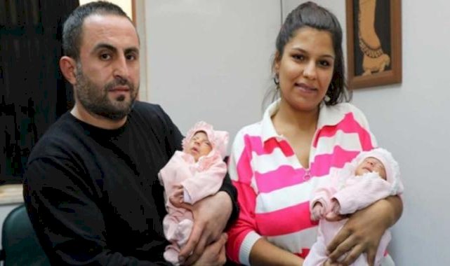 Aynı damarları paylaşan ikizler, anne karnında ameliyatla sağlıklarına kavuştu