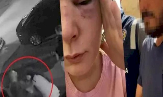 Bursa'da dehşeti yaşattı: Eski sevgilisi vücudunda sigara söndürdü