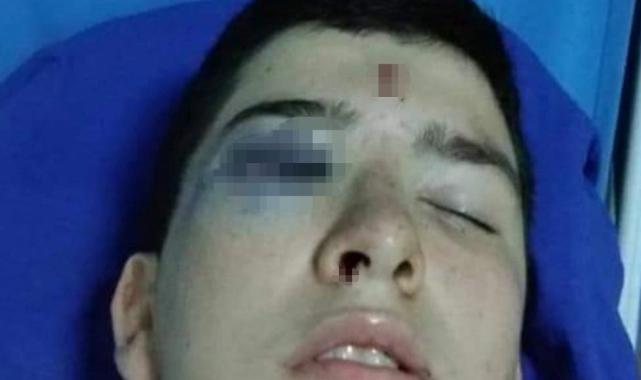 Trabzon’un 8 yıllık yorgun mermi raporu: 5 ölü 100’e yakın yaralı