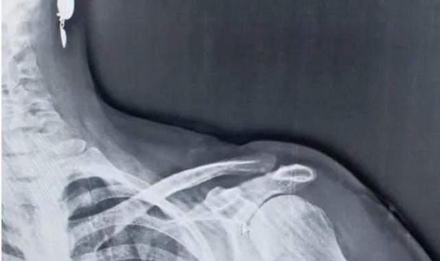 Trabzon’un 8 yıllık yorgun mermi raporu: 5 ölü 100’e yakın yaralı