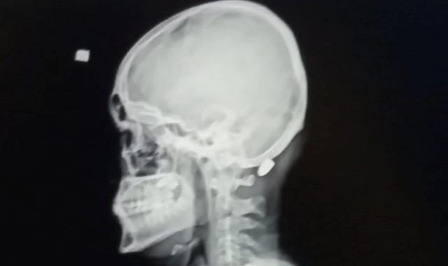 Trabzon’un 8 yıllık yorgun mermi raporu: 5 ölü 100’e yakın yaralı