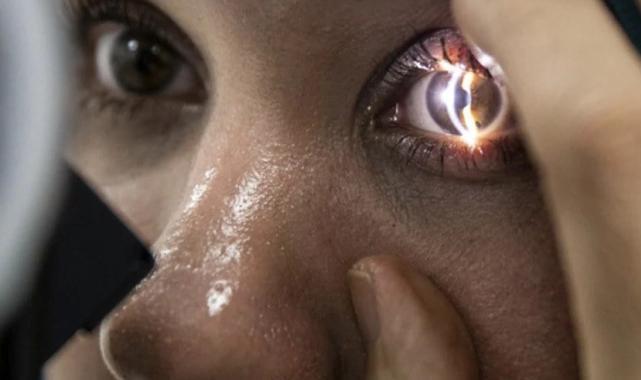 Etkileri araştırıldı! El Nino göz hastalıklarında artışa neden oluyor