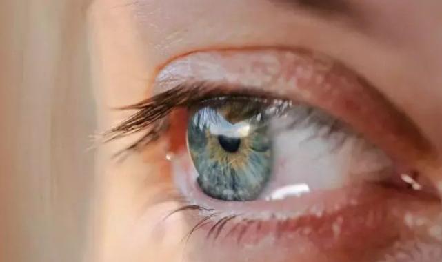 Göz nezlesi kabusunuz olmasın! Hem kış hem bahar aylarının belası: İşte detaylar