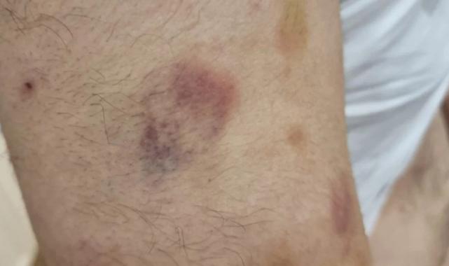 İstanbul'da öğretmen otizmli öğrenciyi darbetti iddiası