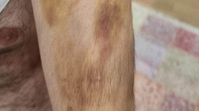 İstanbul&#039;da öğretmen otizmli öğrenciyi darbetti iddiası