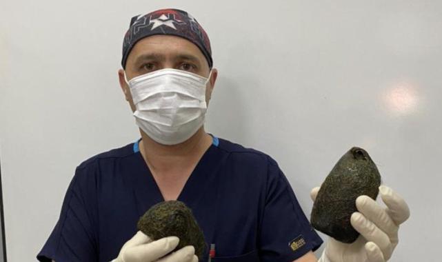 Osmaniye'de karın ağrısı şikayetiyle hastaneye gitti midesinden 2 kilo saç çıktı